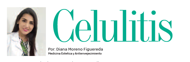 Celulitis